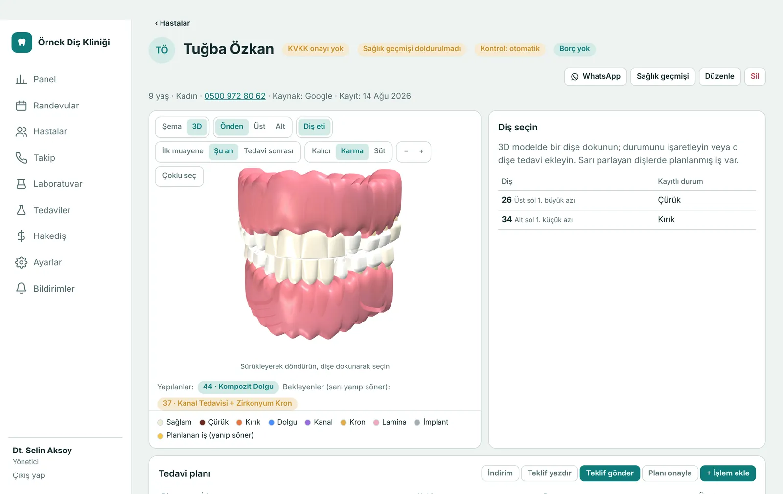 3D diş modeli ve seçili dişin tedavi kayıtları